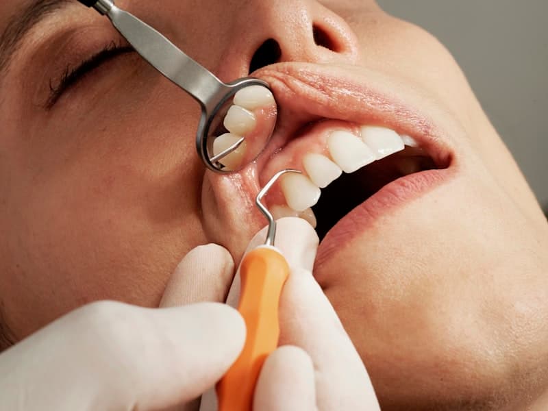 Tẩy trắng răng an toàn tại IVY Dental: Phương pháp, hiệu quả và lưu ý quan trọng