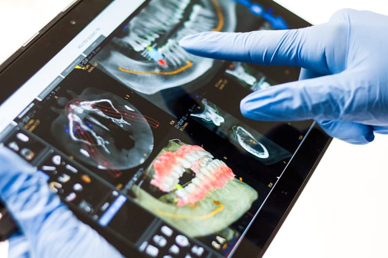 Cấy ghép Implant: Giải pháp phục hồi răng mất vĩnh viễn tại IVY Dental